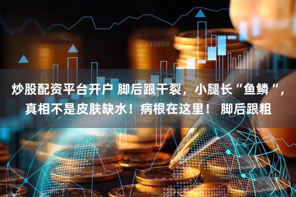 炒股配资平台开户 脚后跟干裂，小腿长“鱼鳞“，真相不是皮肤缺水！病根在这里！ 脚后跟粗